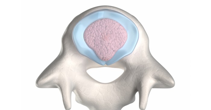 Adhesiolysis laparoscopic