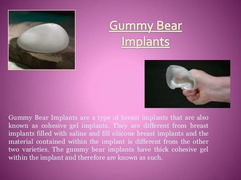 Gummy bear implants making noise